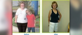 Tighten skin after weight loss