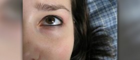 Tired eyes and dark circles