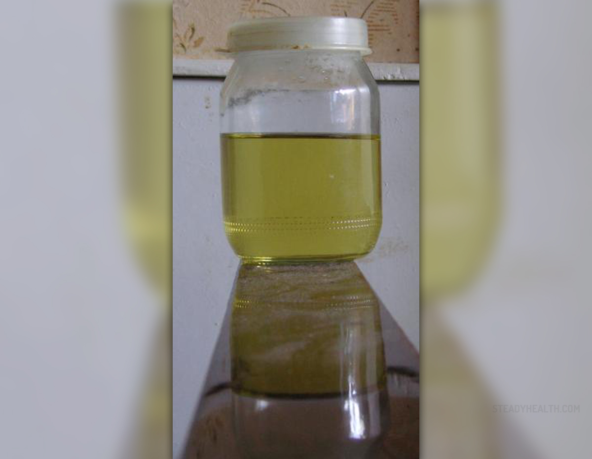 red particles in urine