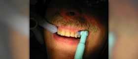 Tooth pain after filling
