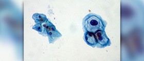 Transmission of high risk HPV