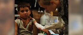Treatment for a second degree burn