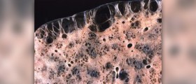 Treatment for pulminary fibrosis