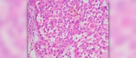 Treatment for squamous cell carcinoma