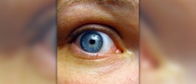 Treatment for wrinkles under eye