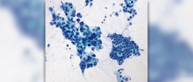 Tretment for inflamed pancreas
