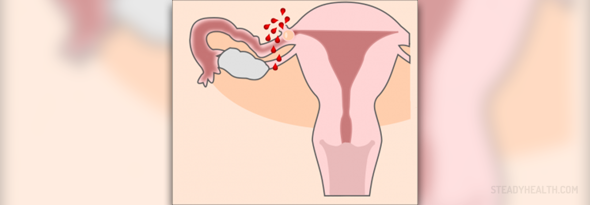 Fallopian tube pregnancy | Pregnancy articles | Family Health center | SteadyHealth.com