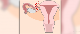 Fallopian tube pregnancy