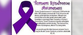 Turner syndrome facts