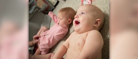 Multiple births statistics: what are the odds of having twins