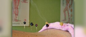 Types of alternative medicine