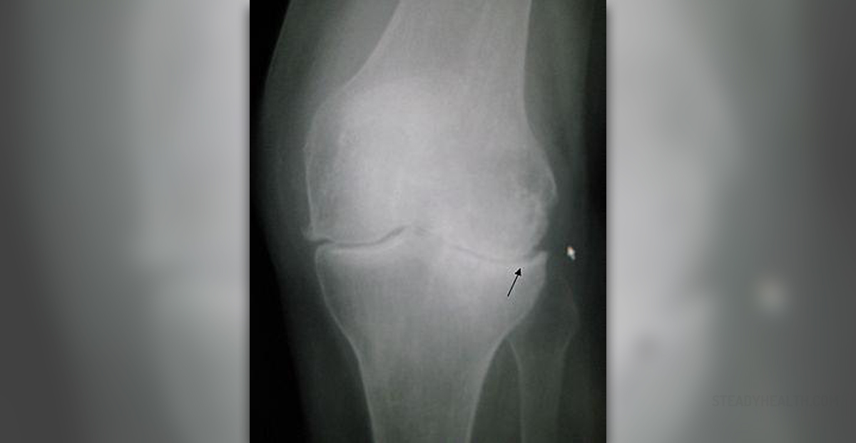 areas where two or more bones join together are