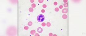 Types of autoimmune diseases