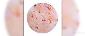 Typhoid prevention facts