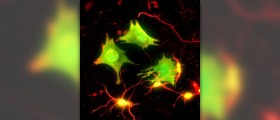 Understanding neuron structure