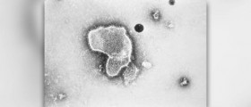 Upper respiratory infection symptoms