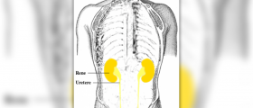 Urinary tract infections in women