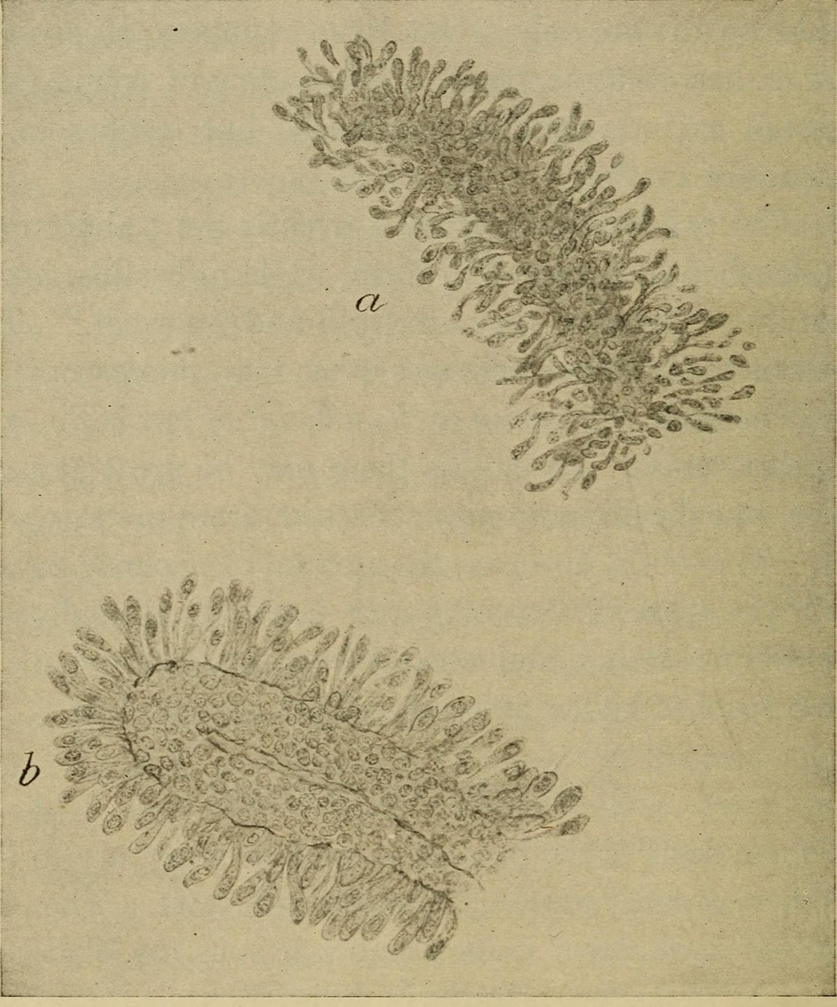 albumin-in-urine-general-center-steadyhealth