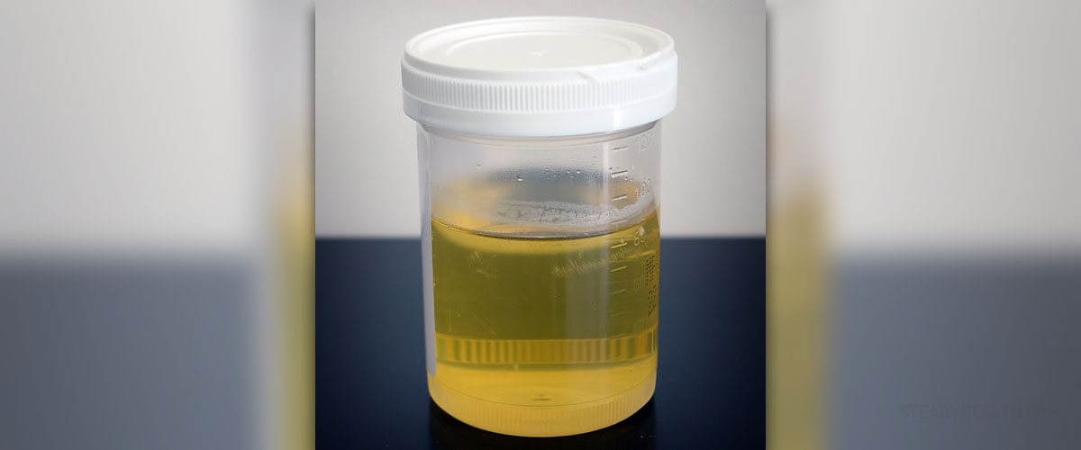 Urine therapy side effects | General center | SteadyHealth.com