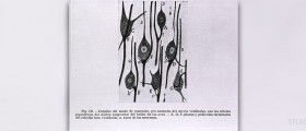 Vestibular disease in humans