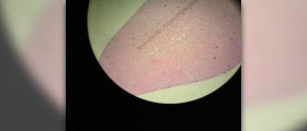 Vitamin C and your adrenal glands