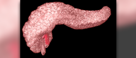 Warning signs for pancreas cancer