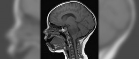 Warning signs of brain tumor