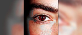Warning signs of skin cancer - what does skin cancer look like ?