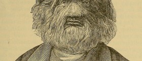 Werewolf syndrome facts