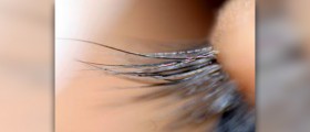 What are eyelash mites