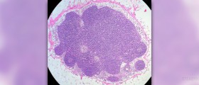 What are lymph nodes