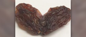 What are the benefits of raisins