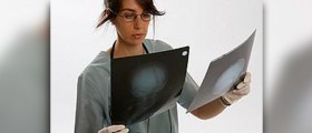 What is diverticulitis
