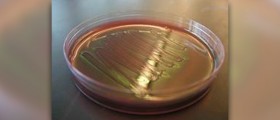 What is e coli treatment