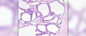 What is pancreatic lipase