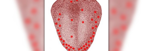 White tongue with red spots