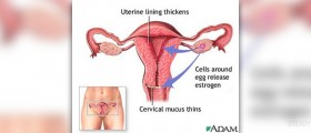 Who can benefit from NovaSure endometrial ablation?