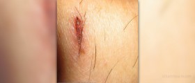 Wound healing herbs