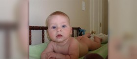 Yeast infection diaper rash