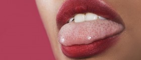A Bump On The Side Of The Tongue