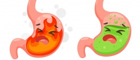 Acid Reflux Treatment Options