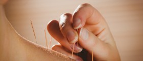 Acupuncture Works, Although Scientists Don't Know Why