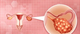 Age And Ovarian Cancer