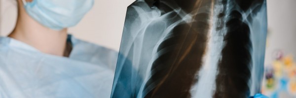 Agent Orange And COPD