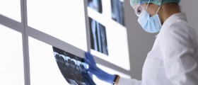 Are You A Candidate For Knuckle Replacement Surgery?