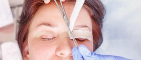 Blepharoplasty Or Eyelid Surgery: What To Expect?