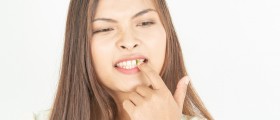 Chromogenic Stains On Your Teeth: Causes And Solutions