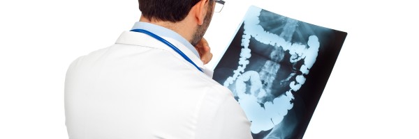 Colon Cancer : Symptoms, Risk Factors, Diagnosis And Treatments