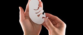 Complications Of An Abortion