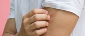 Different Kinds of Skin Rashes And What to Do About Them